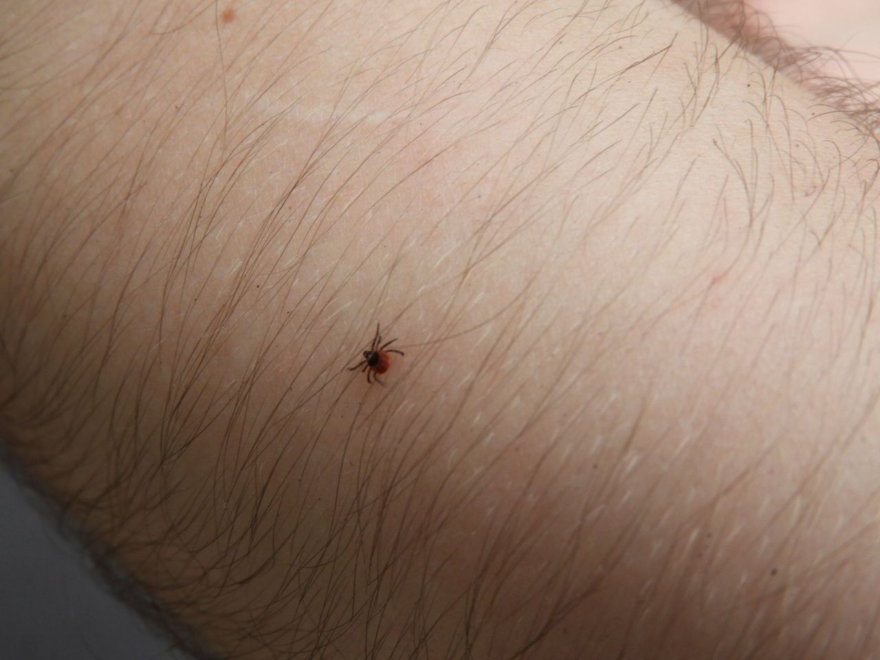 В больнице рассказали о ходе кампании по вакцинации против клещевого энцефалита