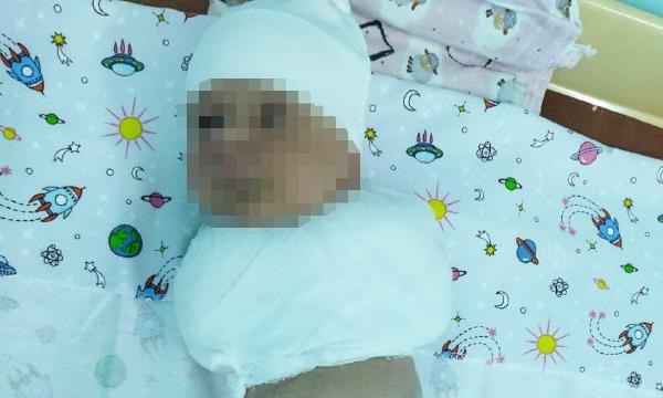 После родов у младенца оказались сломаны ребра и руки. Мама не верит врачам, которые говорят о генетическом заболевании