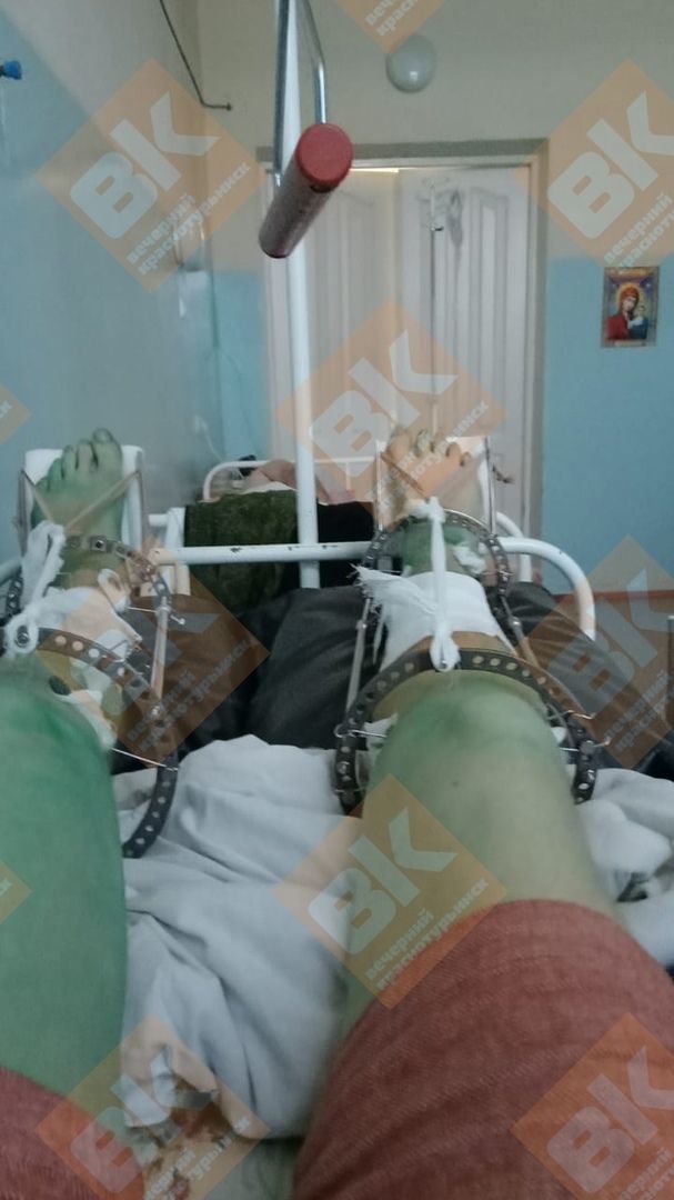 «Потребуется несколько операций»: жена пострадавшего в шахте горняка рассказала о ЧП