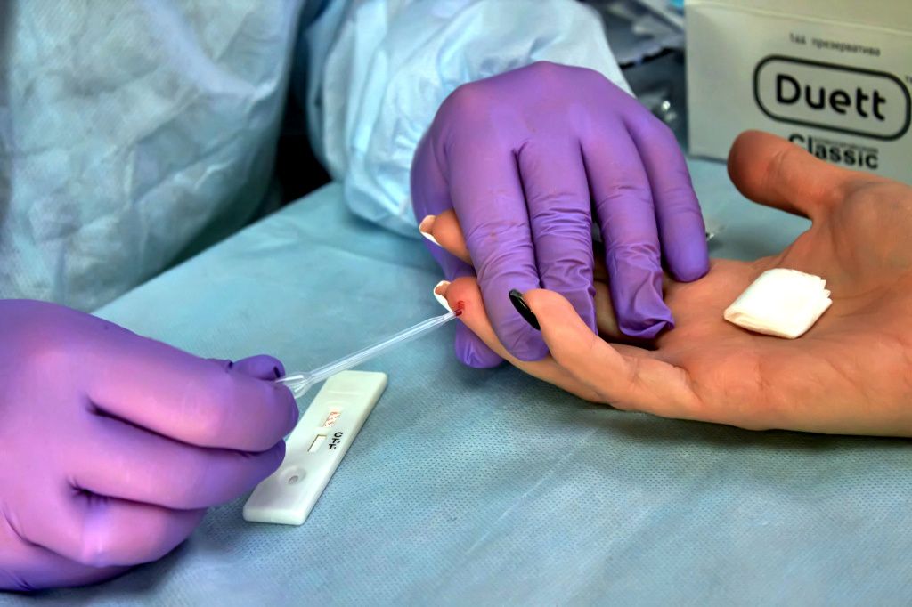 На сегодняшний день самый распространенный способ передачи ВИЧ — незащищенный половой контакт. Далее следует передача инфекции через иглу при употреблении наркотиков. На третьем месте находится вертикальный способ передачи ВИЧ — от матери к ребенку. Фото: Вадим Аминов, "Вечерний Краснотурьинск"