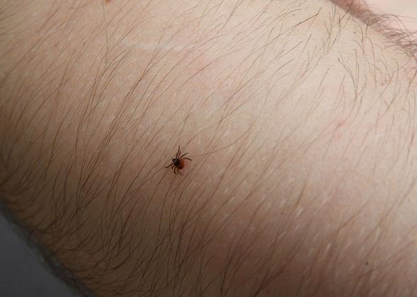 В Краснотурьинске зарегистрировано 12 случаев заболевания клещевыми инфекциями  