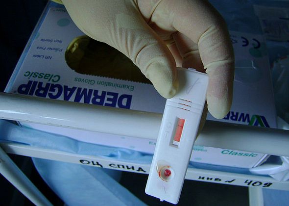 Акция «Узнай свой ВИЧ-статус» пройдет в четверг