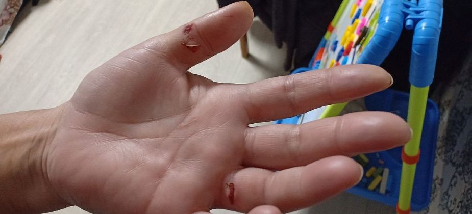 Горожанку покусала собака и загрызла ее той-терьера