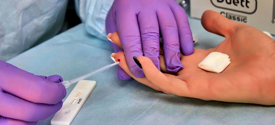 Бесплатное тестирование на ВИЧ пройдет в Краснотурьинске и поселке Рудничном