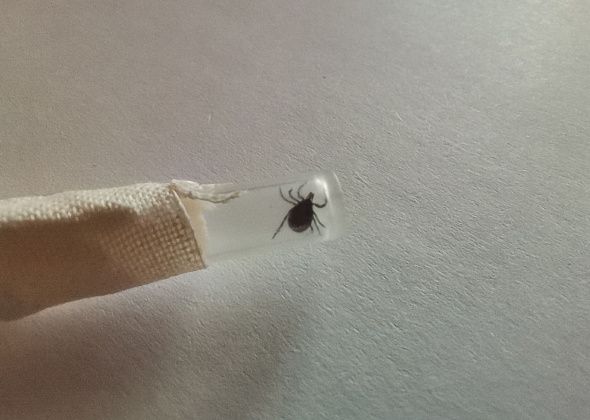 Первые пострадавшие от клещей краснотурьинцы – школьники 8 и 10 лет