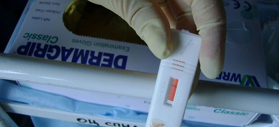 В Краснотурьинске стали чаще болеть ВИЧ