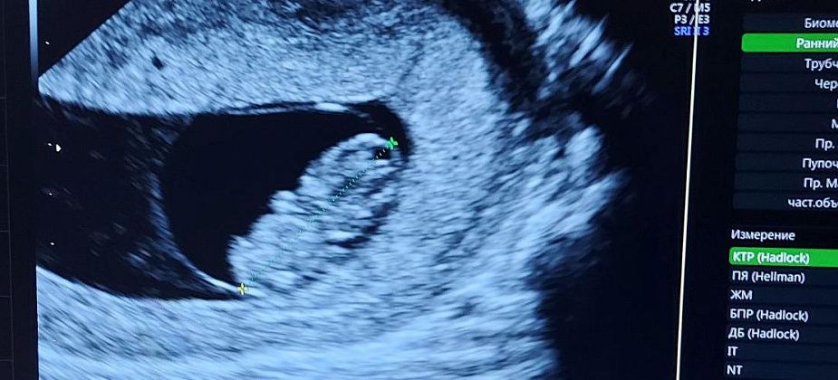 В России запустят реестр беременных женщин