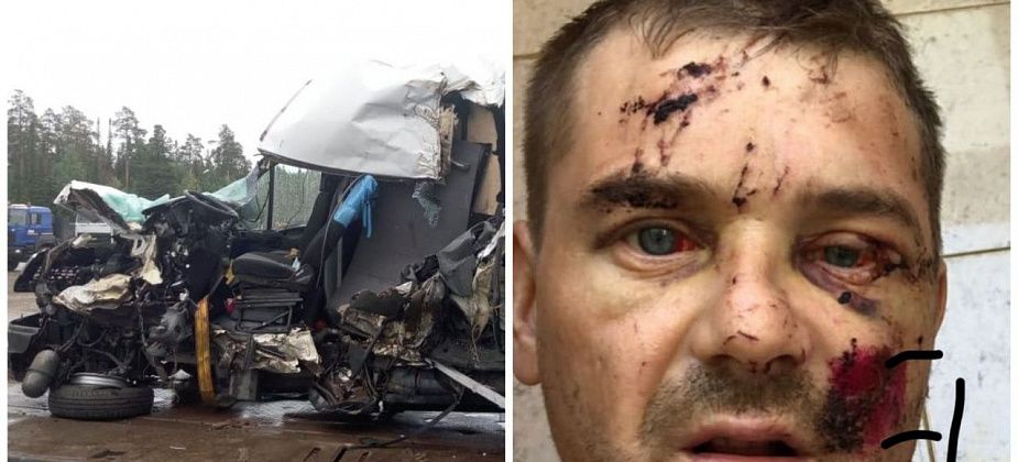«Даже не позвонил, не извинился»: пострадавший в ДТП рассказал о виновнике аварии и жизни после нее